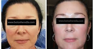 Smart Clinic Armonizador Facial