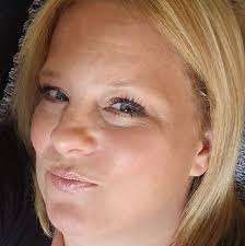 Do lupus patients still experience symptoms during remission?