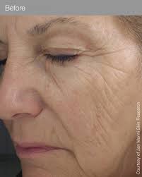 jan marini skin care