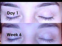 Rapidlash review | latisse comparison. Review Rapidlash Eyelash Enhancing Serum Youtube