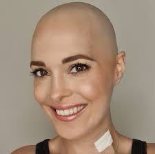 Charelle's Journey with Hodgkins Lymphoma