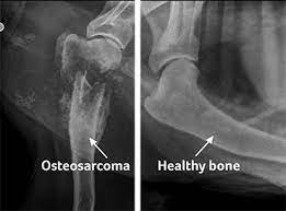 Leukemia bone pain when discussing what does bone pain feel like in leukemia, we tend to remind cancer patients and readers that bone pain is the most common in areas where there is a large amount of bone marrow. Osteosarcoma Bone Cancer In Dogs Pdsa