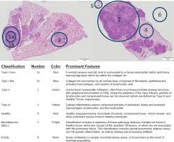 The branch that leads to the right lung is called the right main or primary bronchus. Digital Image Analysis Of Heterogeneous Tuberculosis Pulmonary Pathology In Non Clinical Animal Models Using Deep Convolutional Neural Networks Scientific Reports