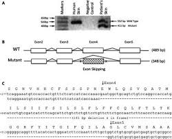PMP22 exon 4 deletion causes ER retention of PMP22 and a gain-of-function  allele in CMT1E