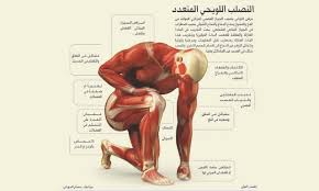 ماهو مرض التصلب اللويحي وما الأعراض المصاحبة له وهل هو وراثي أم لا