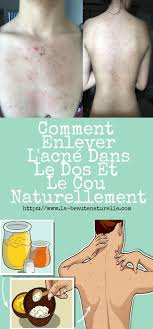 Pin On Recettes Beaute Pour La Peau