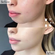 Keys MD Cosmetic Clinic