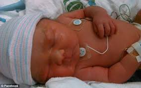 Faça sua escolha entre diversas cenas semelhantes. Healthy Baby Born 23 Weeks After Mother S Death World
