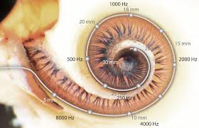 Hearing The Low Frequency Sounds With A Cochlear Implant Is Possible Due To Brain Plasticity Why A Recipient S Hearing G Cochlear Implant Cochlear Ear Anatomy