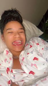 Why Sucking Your Thumb Can RUIN Your Teeth! 🍼🦷 #teeth #openbite #dentist 