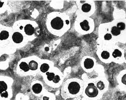 Image result for bulat steel micrograph