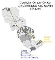 Wiring diagram, black and white, broadcasting. Learning The Wiring Diagram For Autism Spectrum Disorders Eurekalert Science News