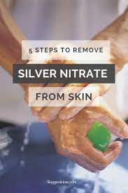 How To Remove Silver Nitrate From Skin 3 Actionable Tips Skin Cleaning Clothes Cleaning Hacks