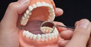 If you have partial dentures, removing them for cleaning is an important part of keeping them in good condition as well as keeping your whole mouth healthy. What S The Difference Between A Tooth Implant And Partial Dentures Mantis Dentistry Implant Center