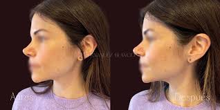 Dr. Andrea De La Puente : Aesthetic Medicine : FB Clinic