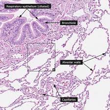 The second image demonstrates the transition from a bronchus on the right to a bronchiole on the left. Normal Lung Overview Insert 200x Human Anatomy And Physiology Respiratory System Anatomy Medical School Stuff