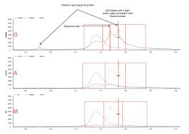 Monoclonal Gammopathy Case Studies Insights