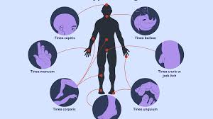 Something that kills mould, mildew, and isn't caustic or with a warning to not use on skin etc. Ringworm Overview And More