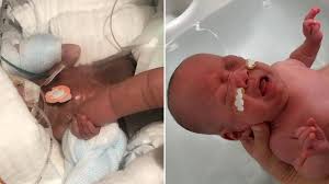Sandra pedro, con 17 semanas de embarazo, llegó a la urgencia con un fuerte de dolor de cabeza el 20 de febrero. El Milagro De Eliska Nacio Cuatro Meses Despues De La Muerte Cerebral De Su Madre
