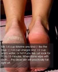 Dry, cracked feet and calloused toes and heels are the worst. Dry Cracked Feet And How To Fix Them Dry Skin On Feet Beauty Care Skin