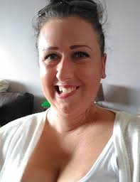 My wonky smile has inspired thousands' Mum whose face was ravaged by skin  cancer because she NEVER wore sun cream shares candid photos