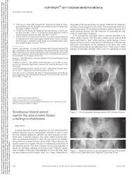 Patients and families need to be counseled about this. Pdf Simultaneous Bilateral Anterior Superior Iliac Spine Avulsion Fracture A Challenge To Rehabilitation