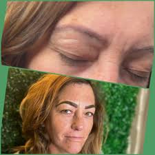 **In the BEFORE (top picture) We did a Color Correction and Cover Up due to  Microblading work that was done(not by me) a while ago. In the before  picture you can see the red and grey areas from the ...