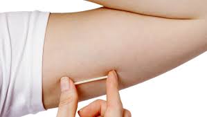 Effectiveness of prolonged use of iud/implant for contraception. Iuds Implants Generate New Enthusiasm And Some Worries