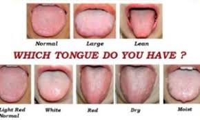Chinese Medicine Tongue Diagnosis Comox Valley Acupuncture