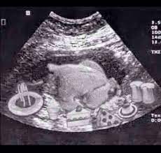 Funny Sonogram With Turkey Funny Babies Sonogram Funny