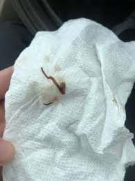 Check spelling or type a new query. Brown Stringy Discharge April 2020 Babies Forums What To Expect