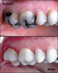 Pin On Blue Back Dental West Hartford