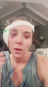 Marcel Vigneron Giving His Mom Hearing Implants