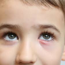 Image result for Blepharis bainesii