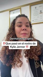 Dermatóloga opina sobre el rostro de Kylie Jenner
