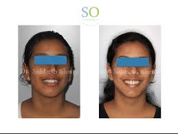 Siddarth Shetty (@shettyorthodontics) • Instagram photos and videos