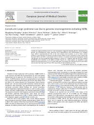 Pdf Cornelia De Lange Syndrome Case Due To Genomic