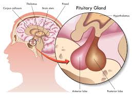 Growth hormone disorder treatment
