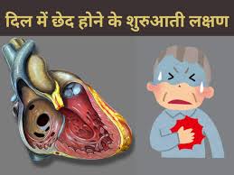 Early Signs Of Hole in Heart | दिल में छेद होना क्या होता है, जानिए दिल में  छेद होने के शुरुआती लक्षण और उपचार | TheHealthSite.com हिंदी