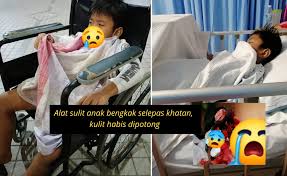 Apakah ring jantung bisa dilepas? Alat Sulit Keluar Banyak Gumpalan Darah Beku Terpaksa Jalani Pembedahan Plastik Bawang Rangers