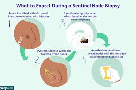 Men can develop breast cancer too, but it's much rarer. Lymph Node Positive Breast Cancer Symptoms And Treatment