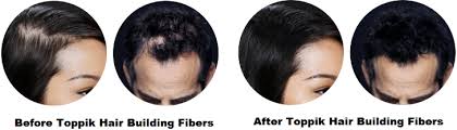 One of them was toppik. Oh Fish Iee Toppik Your Hair Loss Solution