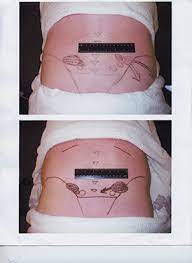 The Problem With The Back Mouse Massagetherapy Com