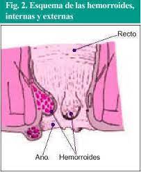 Prurito Anal Farmacia Profesional