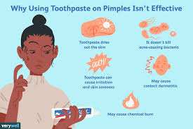 Does Using Toothpaste On Pimples Work