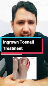 Bacon Fat Ingrown Toenail