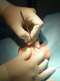 Yeniden yapım ve onarım cerrahisi olarak da isimlendiriliyor. Estetik Plastik Cerrahi Bolumu Ilgi Alanlari