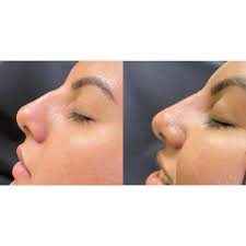 Bambi Lynn Parnell (@injectorbambi) • Instagram photos and videos