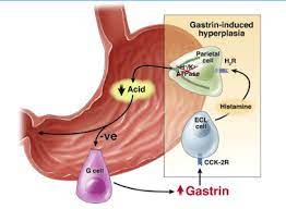 Evidence That Proton Pump Inhibitor Therapy Induces The Symptoms It Is Used To Treat Editorial Protons Prevention Medical Field
