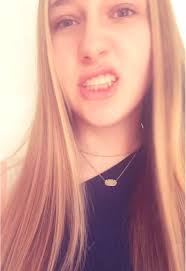 braces are off!! #fyp #blowup #bracesoff #orthodontist #foryoupage #silly